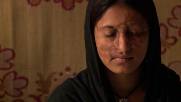 Picture of a female acid attack survivor. She is wearing a black headscarf and her eyes are turned downwards.