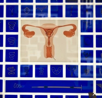 A diagram of the female reproductive organs against a blue backdrop