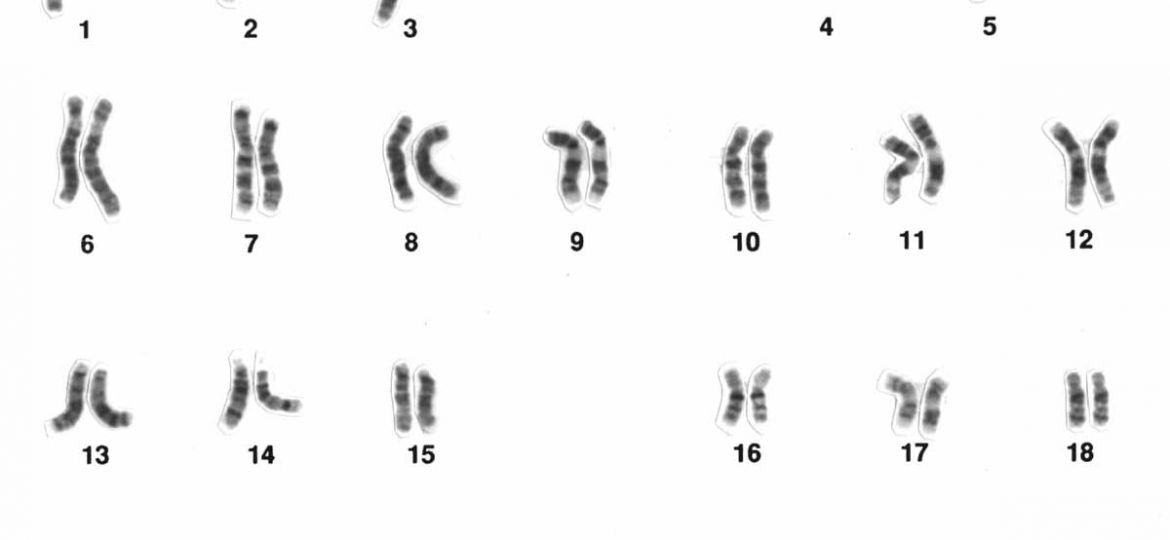 Representation of a human male karotype. Several pairs of chromosomes in the shape of small black lines which differ in length.