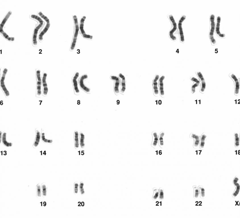 Representation of a human male karotype. Several pairs of chromosomes in the shape of small black lines which differ in length.