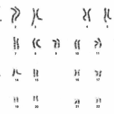 Representation of a human male karotype. Several pairs of chromosomes in the shape of small black lines which differ in length.