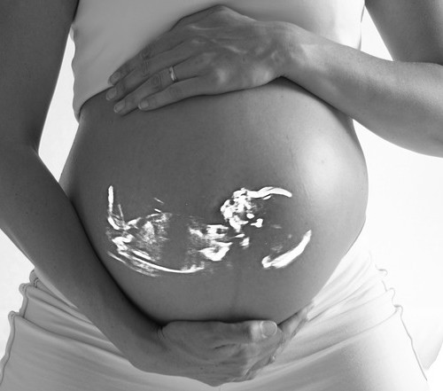 Its a back and white photo of a pregnant woman holding her belly. It also shows a vague outlne of the foetus.