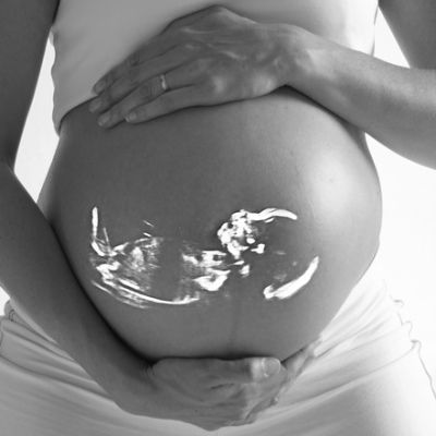 Its a back and white photo of a pregnant woman holding her belly. It also shows a vague outlne of the foetus.