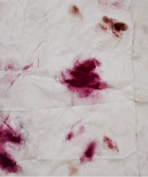 A photograph of a white bedsheet with blots of maroon-burgundy lipstick stains smudged across it.