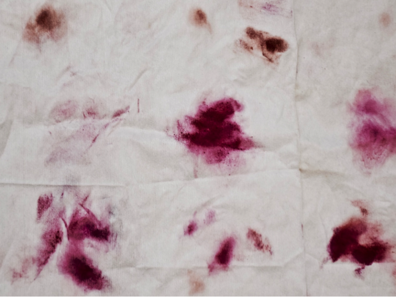 A photograph of a white bedsheet with blots of maroon-burgundy lipstick stains smudged across it.